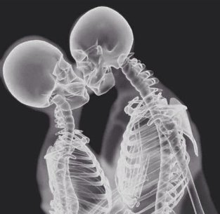 beso esqueletos